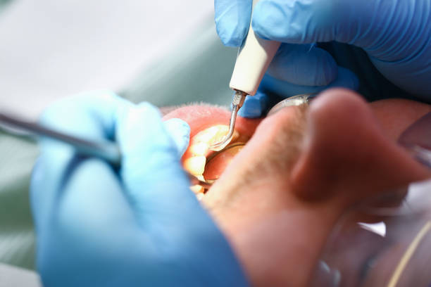 Best Emergency Treatment for Toothache in Jersey Shore, PA