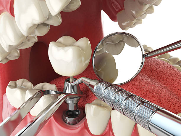 Best Emergency Tooth Extraction in Jersey Shore, PA